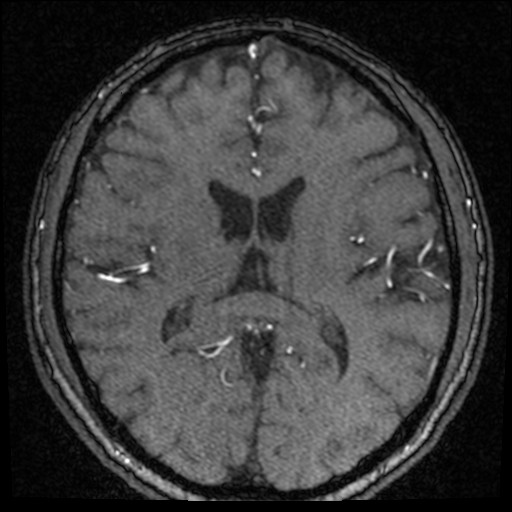 Click on the Serie image to view the images of VILLANUEVA, WILLIAM A.